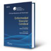 Enfermedad vascular cerebral