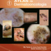 Atlas de dermato-oncología - Imagen 4
