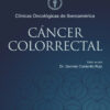 Cáncer colorrectal - Imagen 2