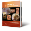Atlas de dermato-oncología