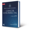 Cáncer colorrectal