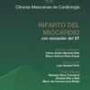 Infarto del miocardio - Imagen 2