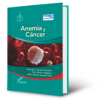 Anemia y cáncer