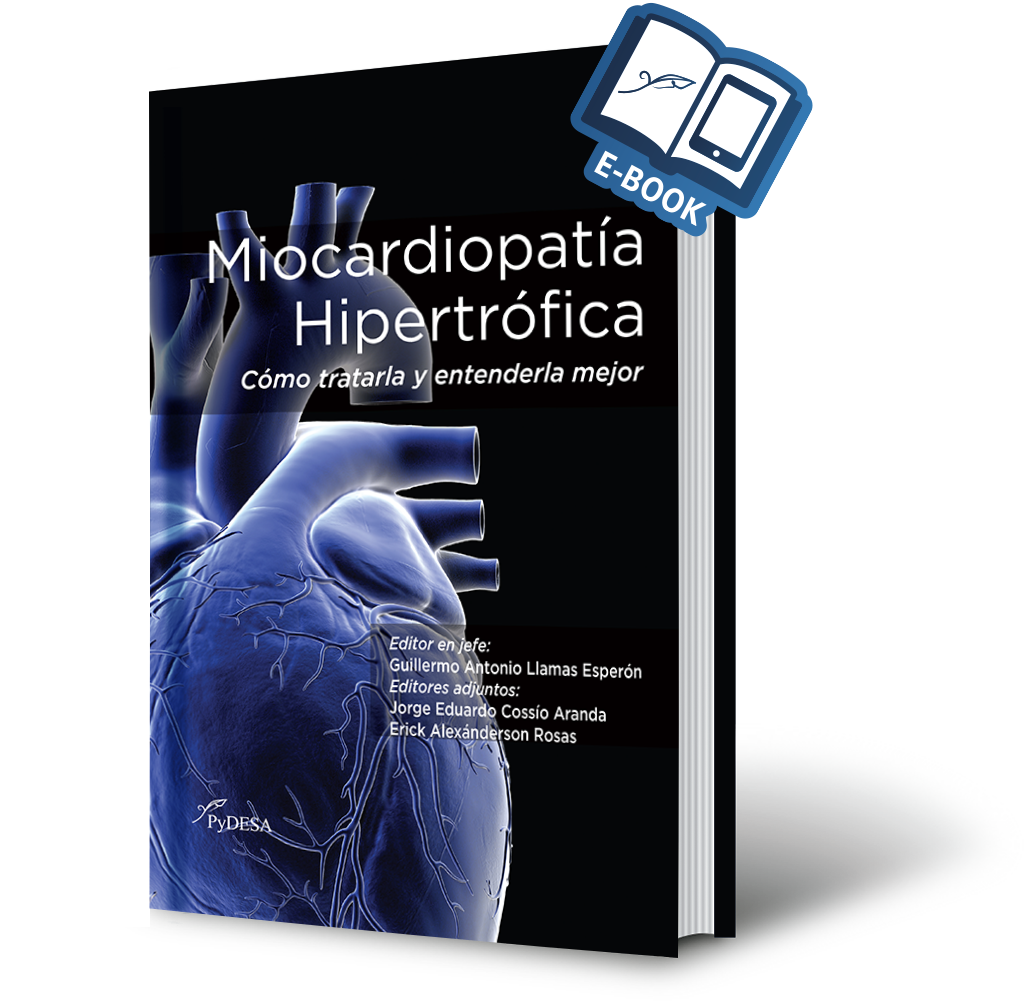 Miocardiopatía Hipertrófica Cómo tratarla y entenderla mejor (ePUB)