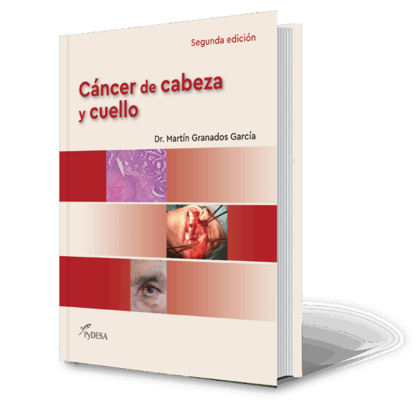 Cáncer de cabeza y cuello (ePUB)