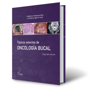 Tópicos selectos de ONCOLOGÍA BUCAL. Segunda edición
